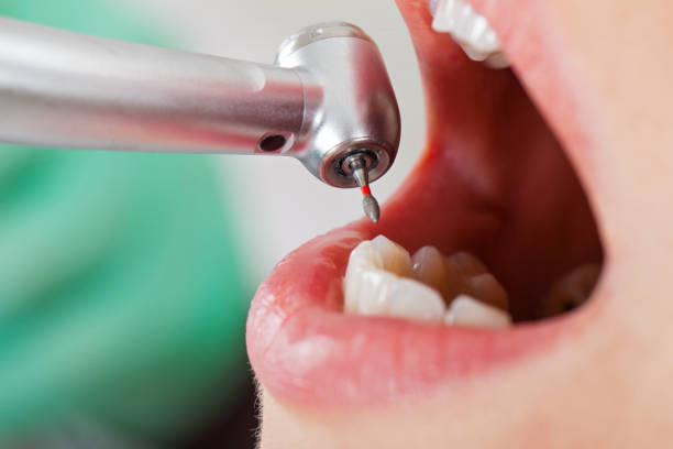 Best Pediatric Emergency Dentist in Cooper City, FL